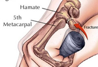 Hamatebone_original_crop_340x234