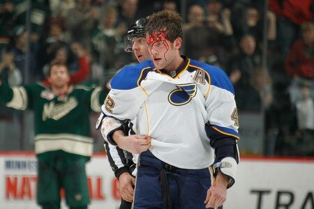 SAINT PAUL, MN - FEBRUARY 12: David Backes #42 of the St. Louis Blues is bloodied after fighting with Clayton Stoner #4 of the Minnesota Wild during the game at Xcel Energy Center on February 12, 2011 in Saint Paul, Minnesota.  <br /><br /><span class="help">(Photo by Bruce Kluckhohn/NHLI via Getty Images)</span>