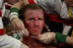 ATLANTIC CITY, NJ - JUNE 7:  Micky Ward is cut over his left eye during his Junior Welterweight bout against Arturo Gatti at Boardwalk Hall on June 7, 2003 in Atlantic City, New Jersey. Gatti won a unanimous decision.  (Photo by Al Bello/Getty Images)