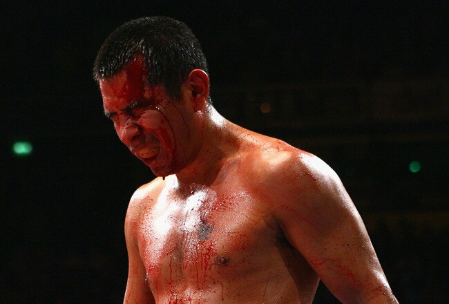 MANCHESTER, UNITED KINGDOM - MARCH 14:  Marc Antonio Barrera grimaces in pain after being cut by Amir Khan during the WBA and WBO Inter-Continental Lightweight title fight between Amir Khan and Marc Antonio Barrera at the MEN Arena on March 14, 2009 in Manchester, England.  (Photo by Alex Livesey/Getty Images)