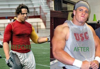 Cushingsteroids8546067xj3_crop_340x234