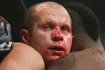 Fedor-emelianenko_nose_crop_150x100
