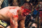 Mma_bloodbaths_ufc_blood-s468x377-15625-580_crop_150x100