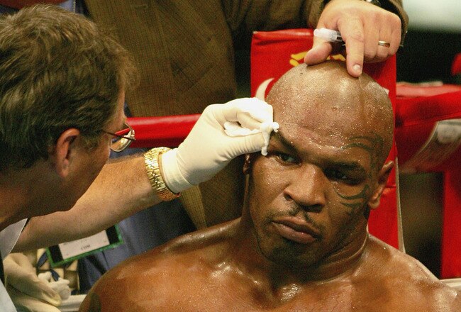 LOUISVILLE, KY - JULY 30: Mike Tyson receives treatment for cut over his eye after the third round against Danny Williams of Great Britain July 30, 2004 at Freedom Hall in Louisville, Kentucky.  (Photo by Matthew Stockman/Getty Images)