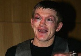 0526_ricky_hatton_getty-1_crop_340x234