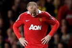 MANCHESTER, ENGLAND - SEPTEMBER 14:  Wayne Rooney of Manchester United grimaces in pain during the UEFA Champions League Group C match between Manchester United and Rangers at Old Trafford on September 14, 2010 in Manchester, England.  (Photo by Alex Livesey/Getty Images)