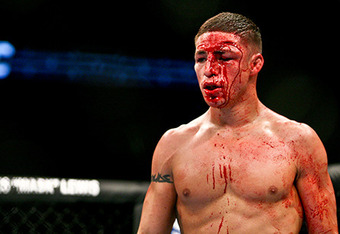 Diego Sanchez Cut