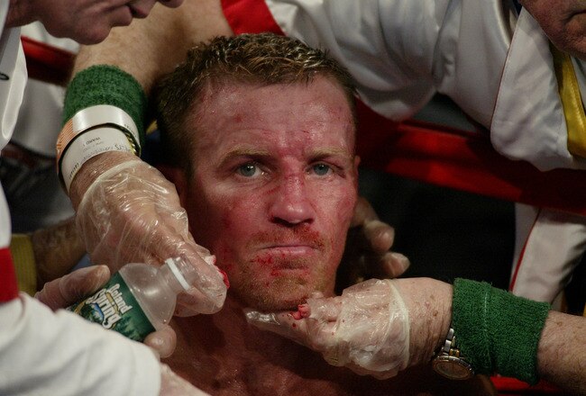 ATLANTIC CITY, NJ - JUNE 7:  Micky Ward is cut over his left eye during his Junior Welterweight bout against Arturo Gatti at Boardwalk Hall on June 7, 2003 in Atlantic City, New Jersey. Gatti won a unanimous decision.  (Photo by Al Bello/Getty Images)