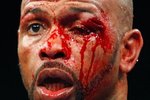 Roy-jones-jr-cut-eye_crop_150x100