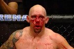 Carwin_bloody_face_large_crop_150x100