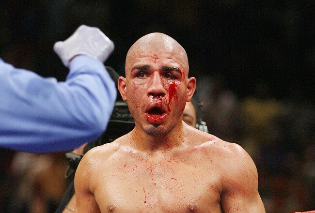 LAS VEGAS - JULY 26:  Miguel Cotto gets an eight-count after being knocked down by Antonio Margarito during their WBA welterweight title fight at the MGM Grand Garden Arena July 26, 2008 in Las Vegas, Nevada. Margarito won by TKO in the 11th round.  (Photo by Ethan Miller/Getty Images)