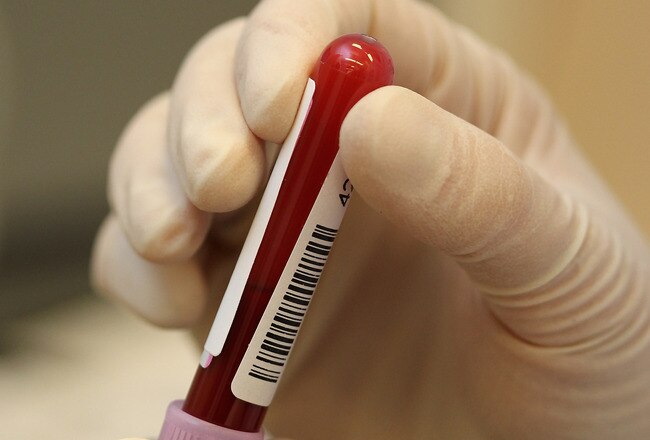 VANCOUVER, BC - FEBRUARY 09:  A lab technician performs a blood test during a tour of the IOC Anti-Doping Laboratory at the Richmond Olympic Oval on February 9, 2010 in Vancouver, Canada.  (Photo by Alex Livesey/Getty Images)