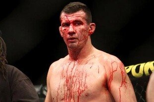 Perosh-bleeds_original_crop_310x205