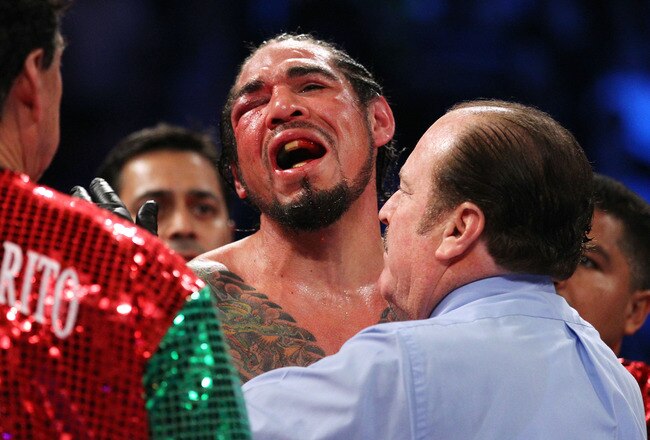 NEW YORK, NY - DECEMBER 03:  Antonio Margarito of Mexico reacts after referee Steve Smoger (R) calls the fight due to Margarito's closed right eye against Miguel Cotto of Puerto Rico in the tenth round during the WBA World Junior Middleweight Title fight at Madison Square Garden on December 3, 2011 in New York City.  (Photo by Al Bello/Getty Images)