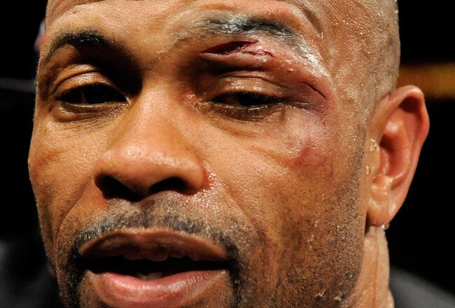 LAS VEGAS - APRIL 03:  Roy Jones Jr. appears with a cut over his left eye after his loss by unanimous decision to Bernard Hopkins in their light heavyweight bout at the Mandalay Bay Events Center April 3, 2010 in Las Vegas, Nevada.  (Photo by Ethan Miller/Getty Images)