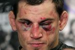 Jon-fitch-injured_crop_150x100