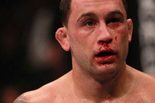 11_edgar_maynard16_large_crop_310x205