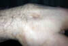 Vitor-broken-hand_crop_100x68