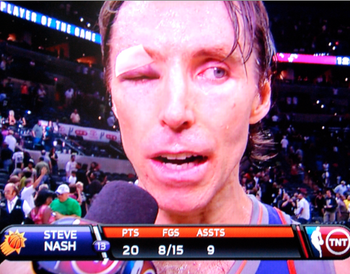 Steve-Nash-sweeps-Spurs-with-one-eyeball_display_image.png