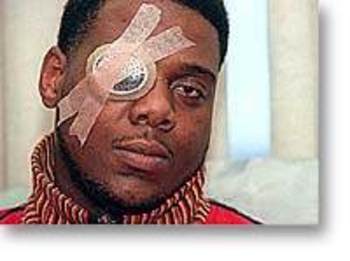 orlando-brown-eye-injury_display_image.j