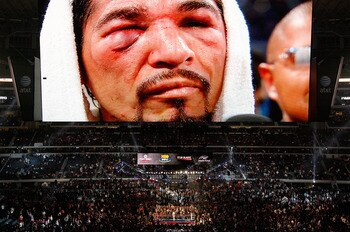ARLINGTON, TX - NOVEMBER 13:  The likeness of Antonio Margarito (black trunks) of Mexico is seen on the giant screen as he is interviewed after he lost to Manny Pacquiao (white trunks) of the Philippines during their WBC World Super Welterweight Title bou