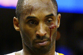 kobebloody_display_image.jpg