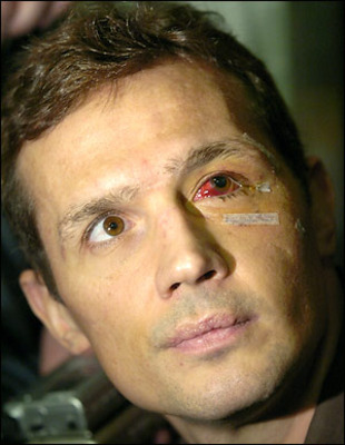 Yzerman Eye