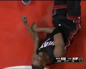 Chris Bosh, after looking directly at a spotlight.