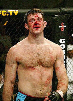 Forrest-Griffin_display_image.jpg