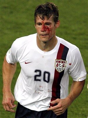 Brian-mcbride-blood_display_image