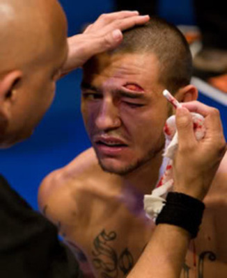 svar vogn Mellem NSFW] Jose Aldo damage to Cub Swanson after flying knee's : r/MMA