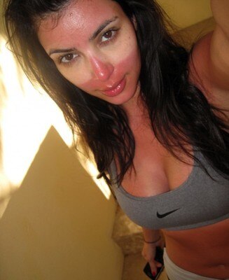 Sunburn_display_image