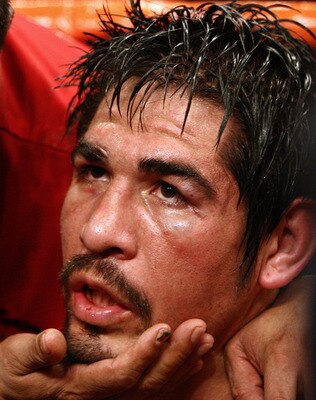 Margarito knocked loopy