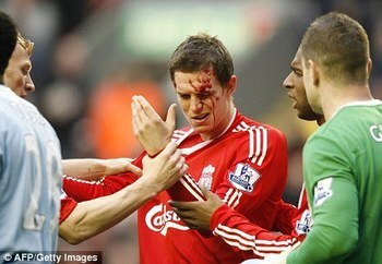 Bloodyagger_display_image
