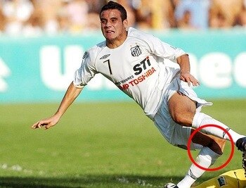 Kneepain_display_image