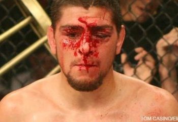 Nick-diaz-elitephoto_crop_340x234_display_image