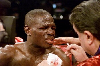 28 Jul 2001:  Andrew Lewis  has his eye looked at after Ricardo Mayorga head butted him in the second round. The result was a no contest due to accidental head butt.  DIGITAL IMAGE. Mandatory Credit: Jed Jacobsohn/Allsport