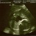 Matthew Bates
