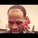 Lebrons Hairline