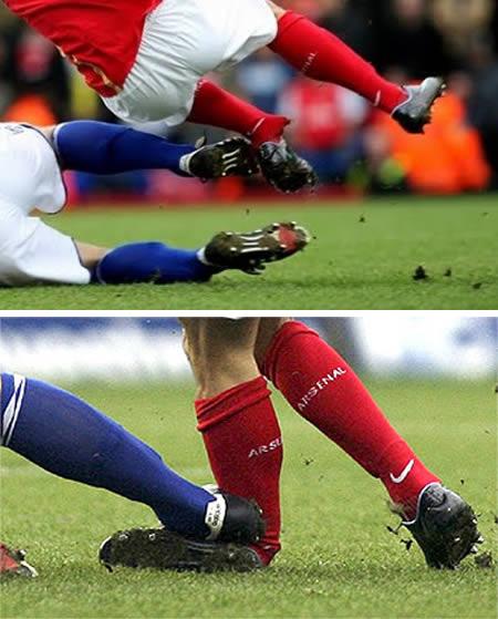 FIFA World Cup 2010 10 Worst Soccer Injuries Of All Time With Video FIFA World Cup 2010 10 Worst Soccer Injuries Of All Time With Video
