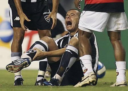 FIFA World Cup 2010: 10 Worst Soccer Injuries of All-Time (With Video) |  Bleacher Report | Latest News, Videos and Highlights