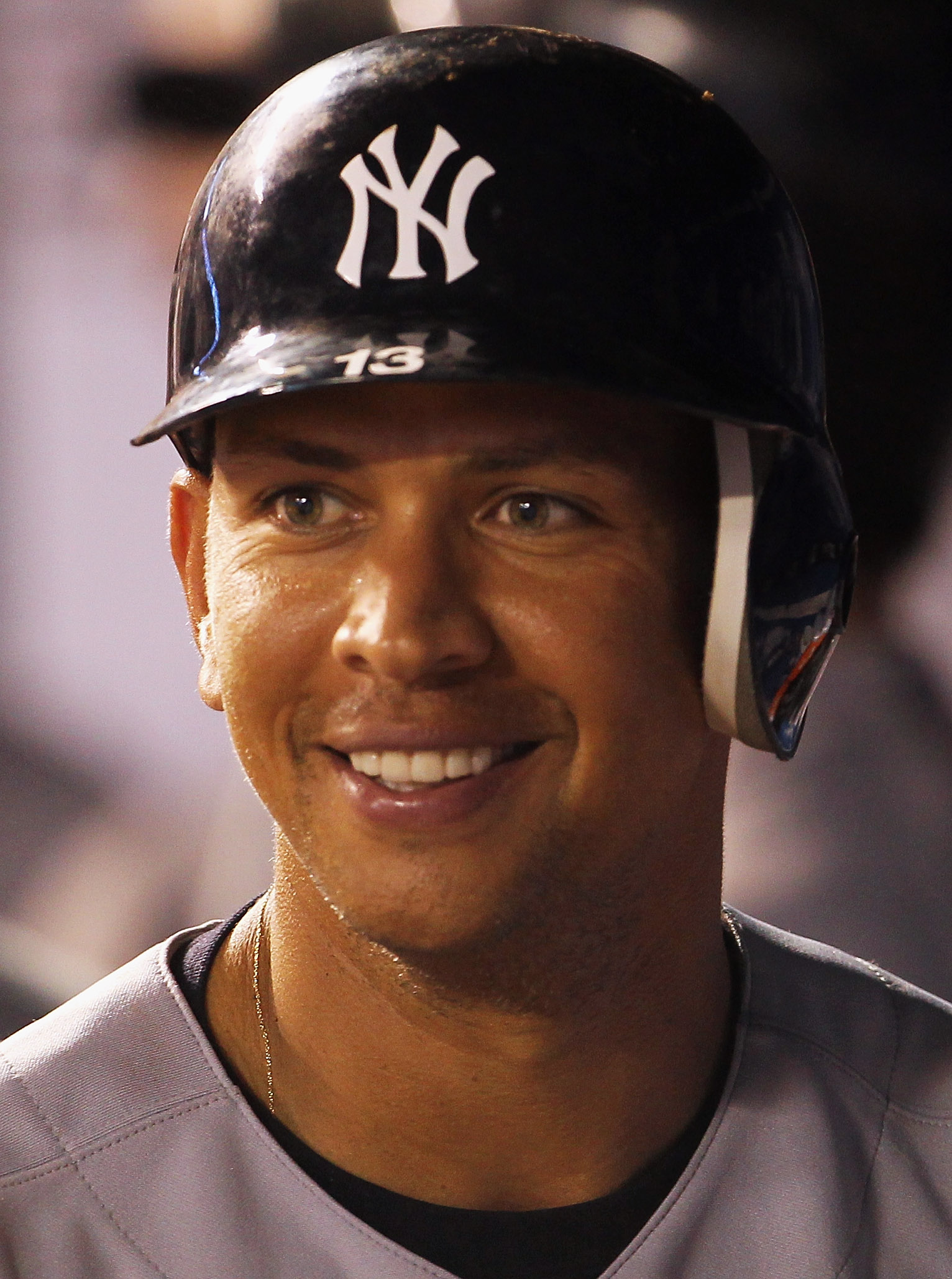 Alex Rodriguez Teeth Pictures