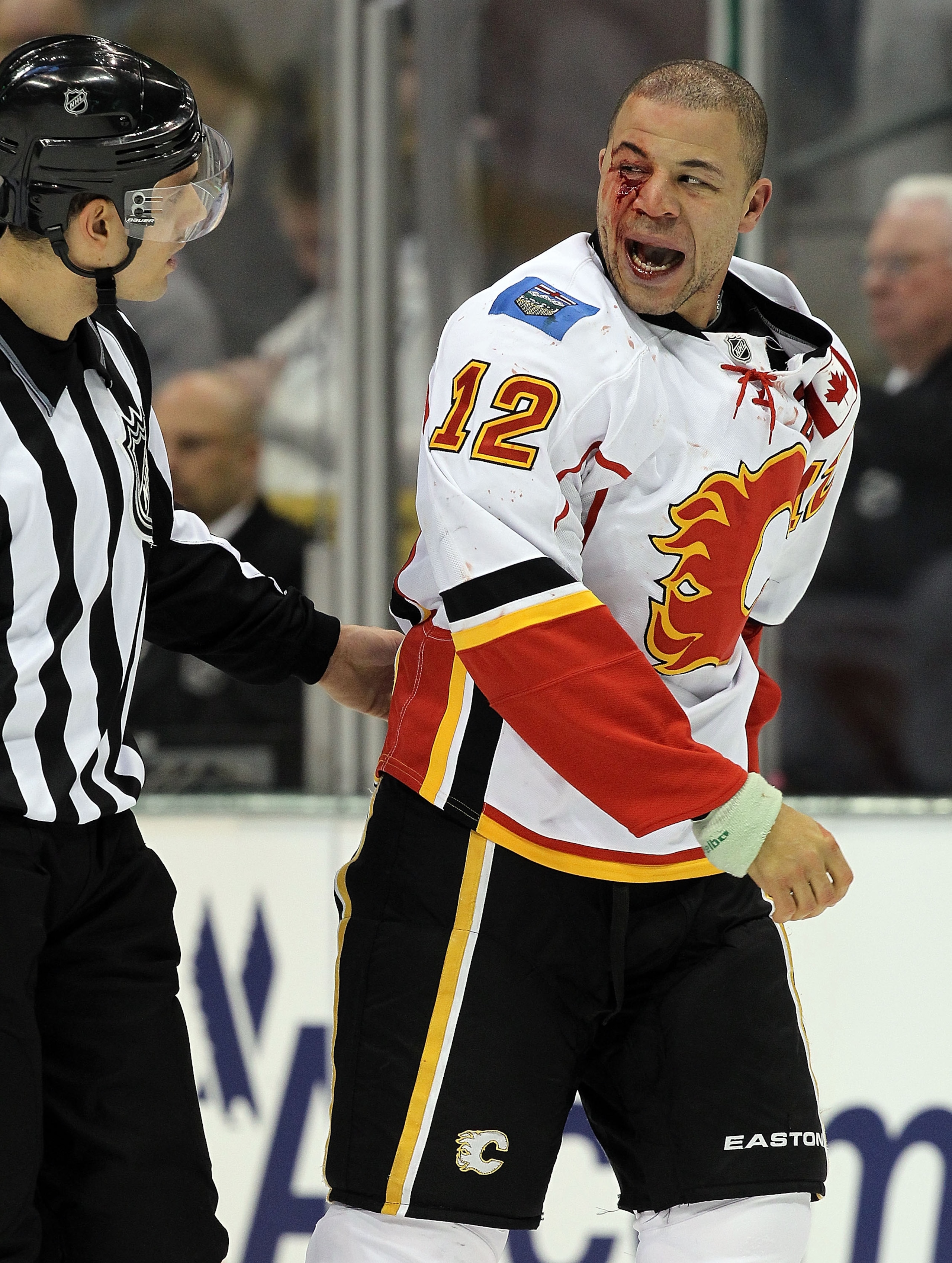 DALLAS, TX - DECEMBER 23:  Right wing Jarome Iginla #12 of the Calgary Flames bleeds after a fight against Jamie Benn #14 of the Dallas Stars at American Airlines Center on December 23, 2010 in Dallas, Texas.  (Photo by Ronald Martinez/Getty Images)