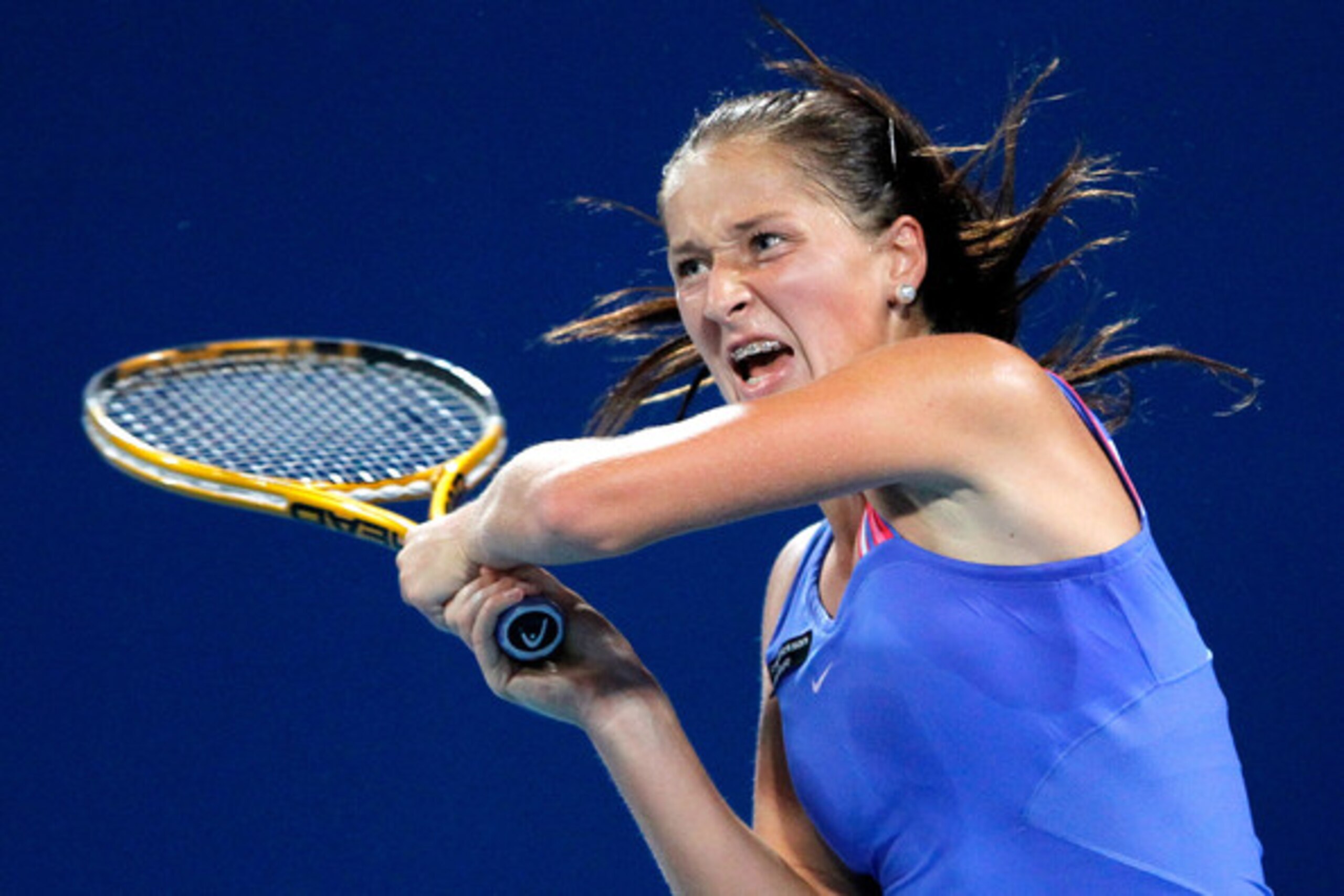 Yep, even pro tennis players have the privilege of suffering through braces