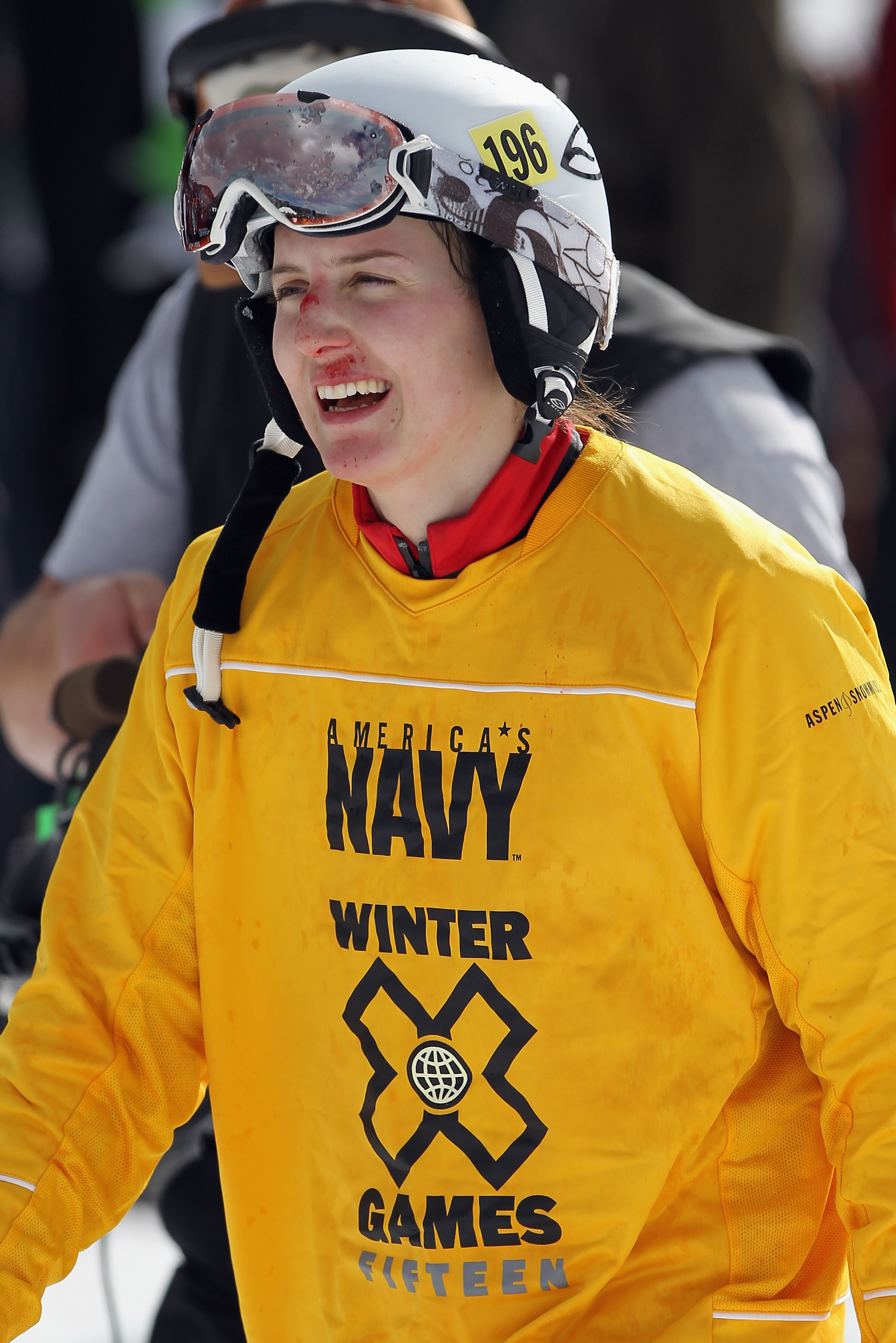 ASPEN, CO - JANUARY 30: Kelsey Serwa of Canada exhibits her wounds after crashing at the finish line to win the gold medal in the finals of the Women's Skier X at Winter X Games 15 at Buttermilk Mountain on January 30, 2011 in Aspen, Colorado. (Photo by