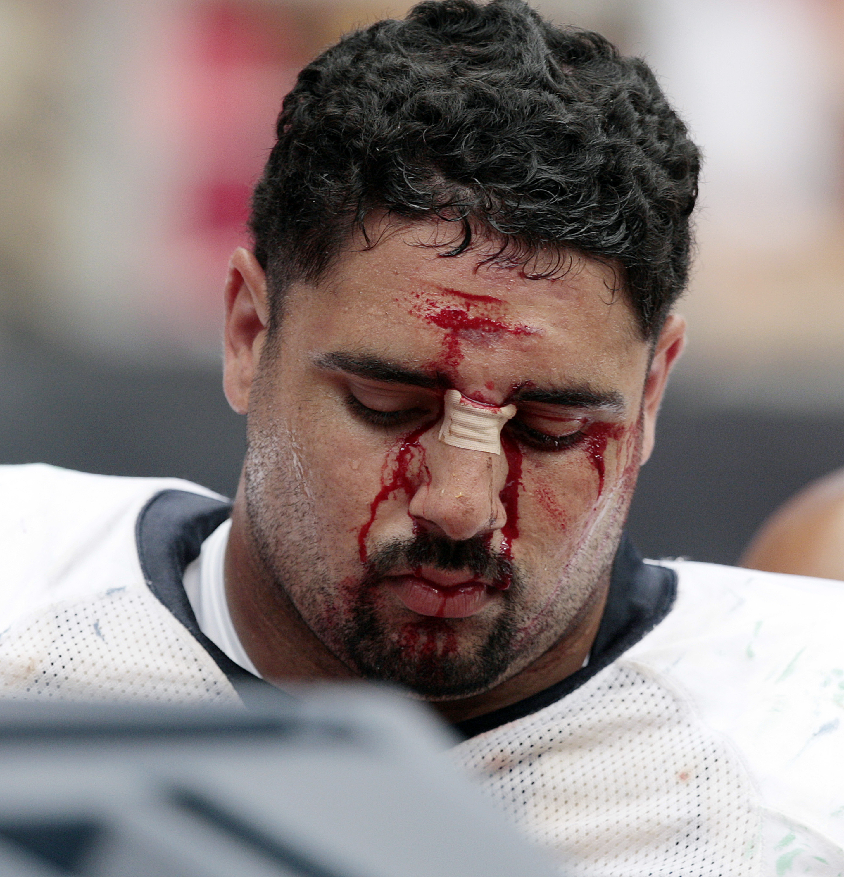 HOUSTON - SEPTEMBER 13:  Defensive tackle Shaun Cody #95 is treated on the sidelines after taking a hard hit at Reliant Stadium on September 13, 2009 in Houston, Texas.  (Photo by Bob Levey/Getty Images)