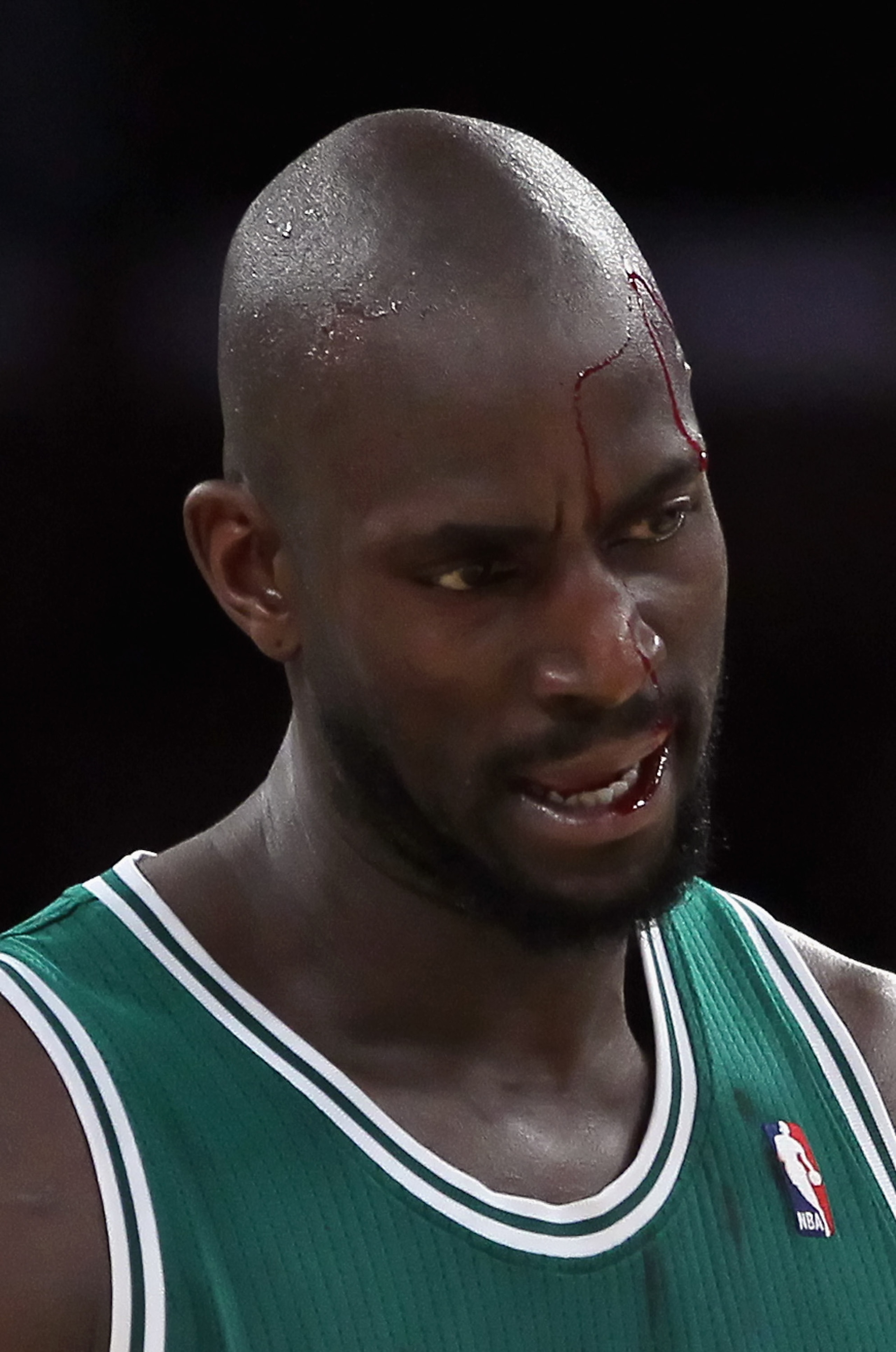 LOS ANGELES, CA - JANUARY 30:  Kevin Garnett #5 of the Boston Celtics is cut above his left eye against the Los Angeles Lakers in the first half at Staples Center on January 30, 2011 in Los Angeles, California. The Celtics defeated the Lakers 109-96.  (Ph