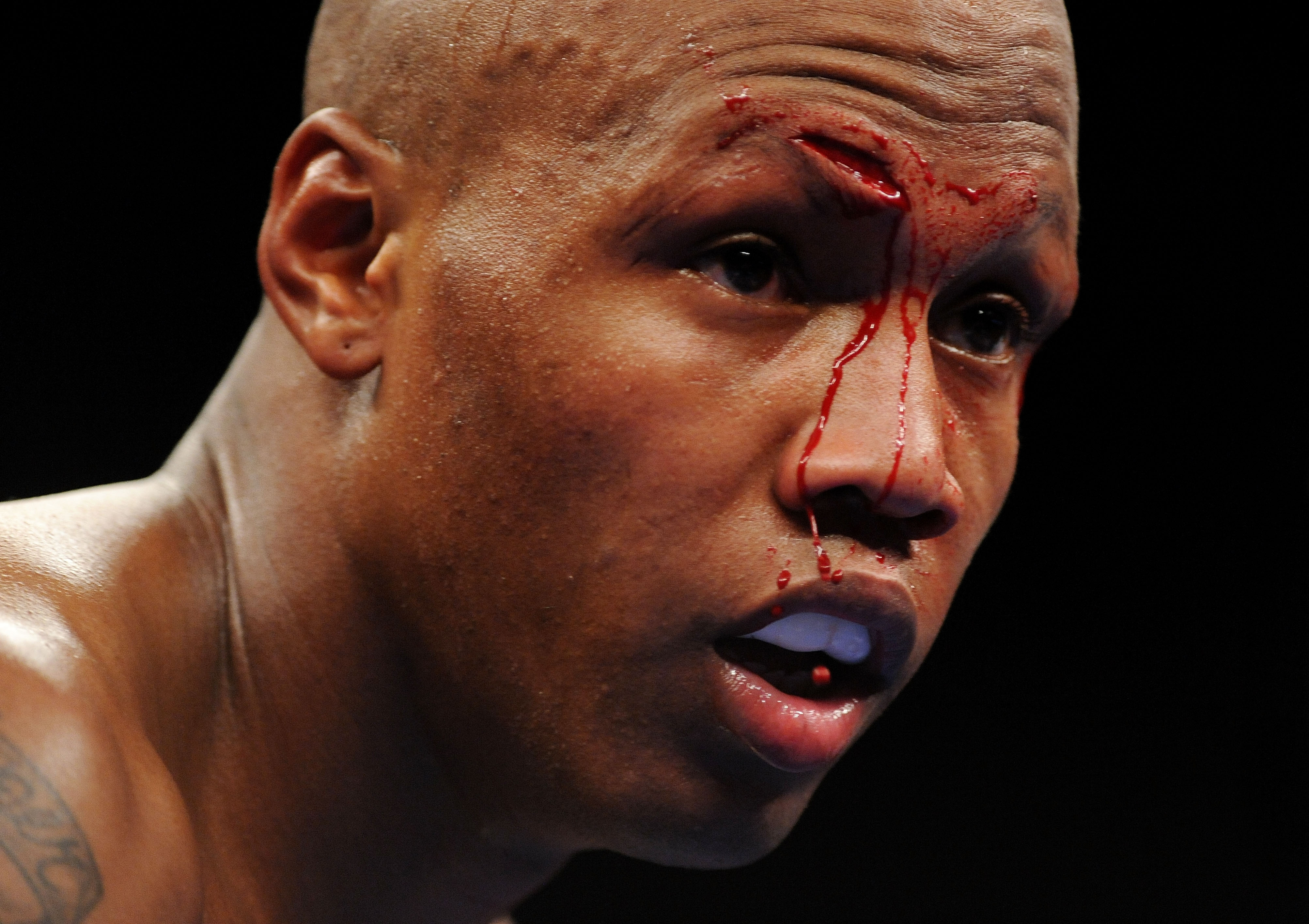 NEW YORK - NOVEMBER 08: Zab Judah looks on while blood drips down his face from a wound received from opponent Ernest Johnson during their Welterweight bout at Madison Square Garden November 8, 2008 in New York City. (Photo by Al Bello/Getty Images)