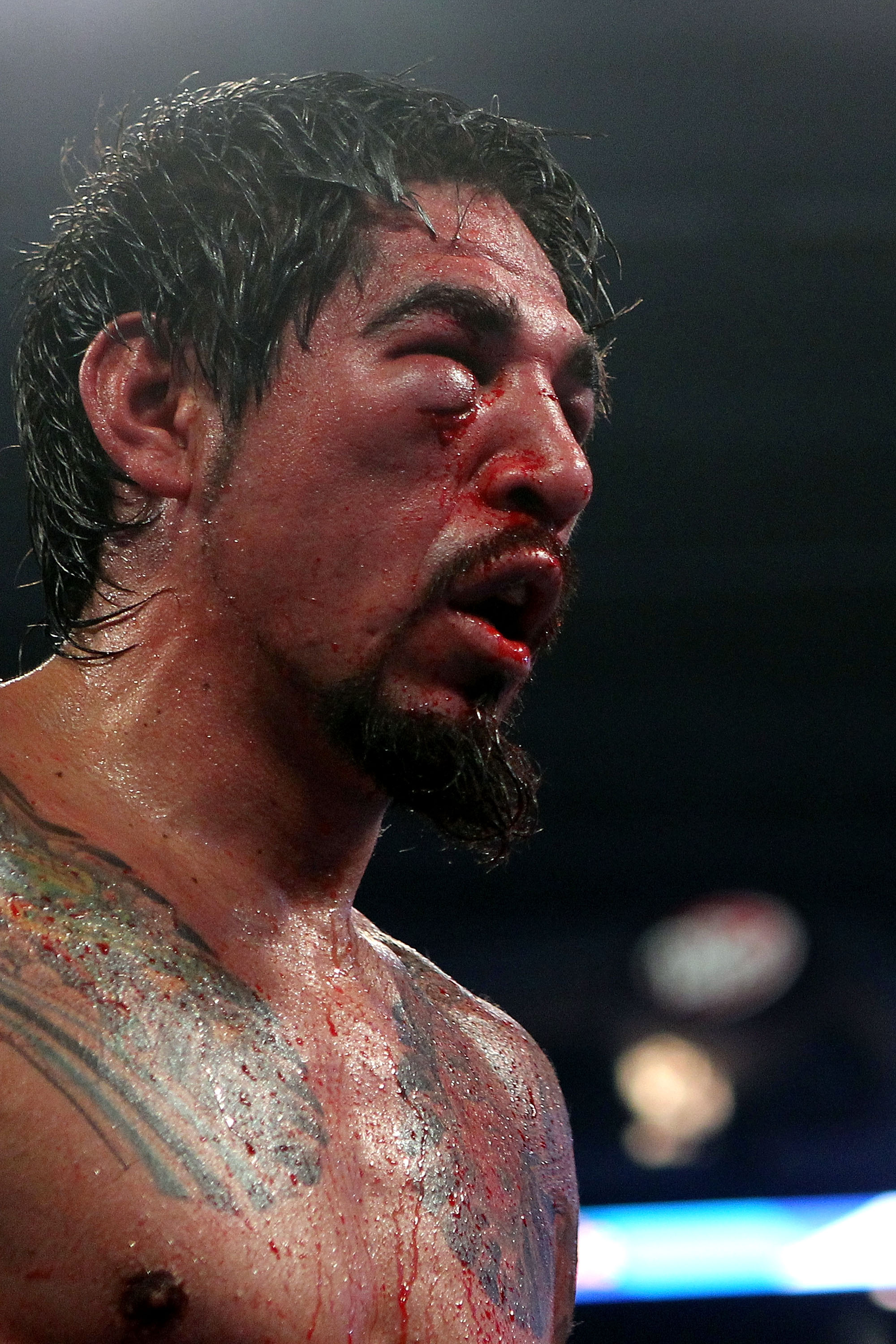 ARLINGTON, TX - NOVEMBER 13:  A detail of the cut on the right eye of Antonio Margarito (black trunks) of Mexico is seen as he fights against Manny Pacquiao (white trunks) of the Philippines during their WBC World Super Welterweight Title bout at Cowboys