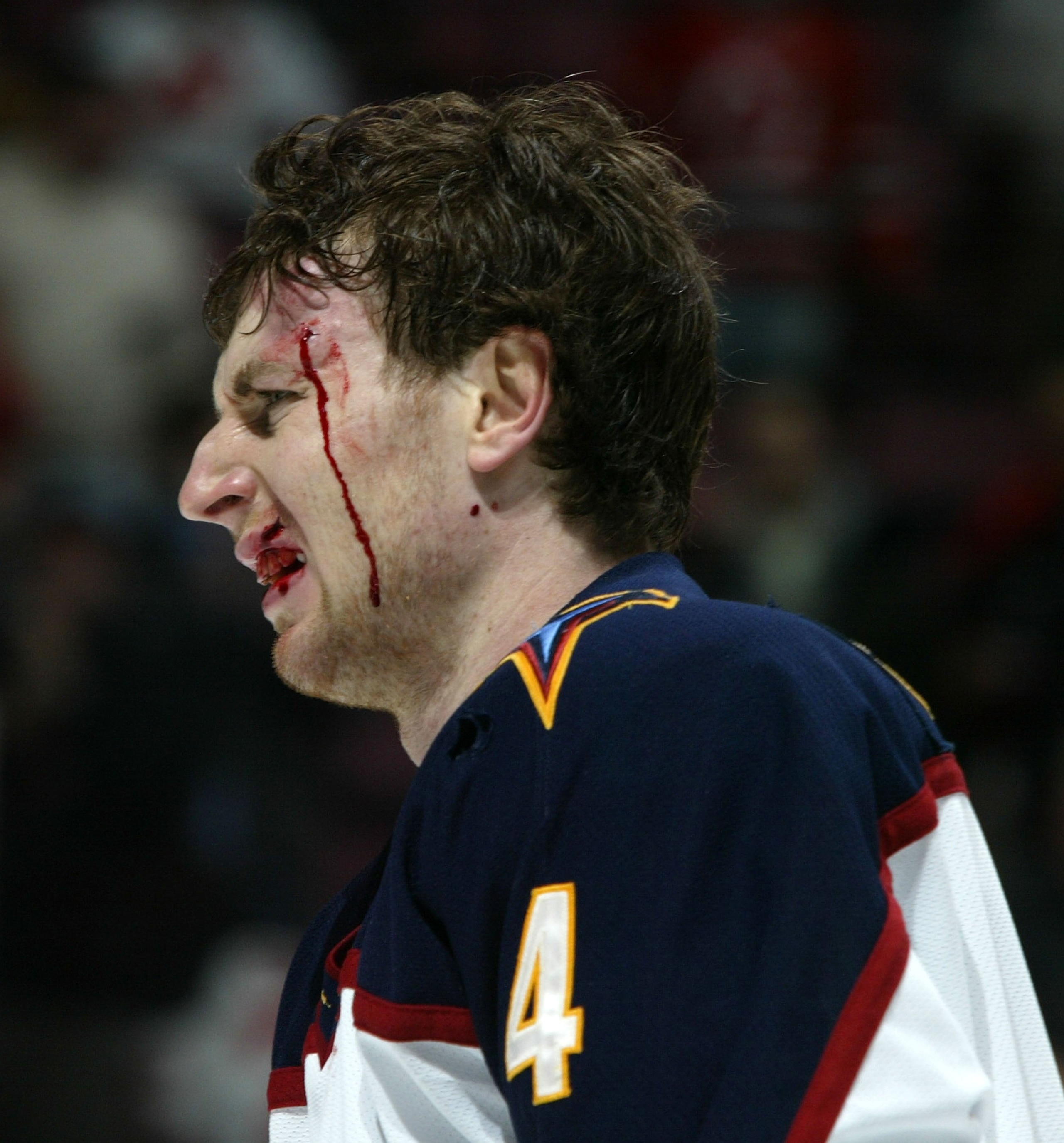 EAST RUTHERFORD, NJ - JANUARY 12: Braydon Coburn #4 of the Atlanta Thrashers goes off the ice bloodied after his fight with Mike Rupp (not pictured) of the New Jersey Devils at the Continental Airlines Arena on January 12, 2007 in East Rutherford, New Jer EAST RUTHERFORD, NJ - JANUARY 12: Braydon Coburn #4 of the Atlanta Thrashers goes off the ice bloodied after his fight with Mike Rupp (not pictured) of the New Jersey Devils at the Continental Airlines Arena on January 12, 2007 in East Rutherford, New Jer